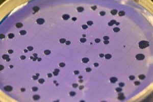 Bacteria on petri dish