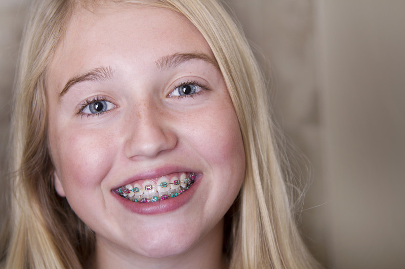 Does My Child Need Braces? Caring Tree Children's Dentistry