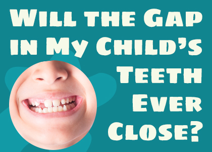 Grass Valley & Lincoln dentist Dr. Kucera of Caring Tree Children’s Dentistry talks about potential causes and treatments for gapped teeth in children.