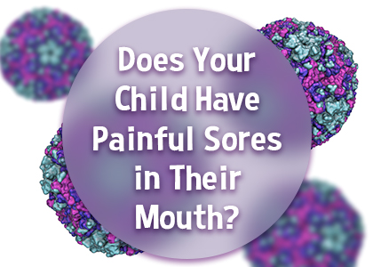 Lincoln & Grass Valley pediatric dentist, Dr. Michelle Kucera at Caring Tree Children’s Dentistry, Inc. tells parents about a common viral infection that may present with sores in your child’s mouth.