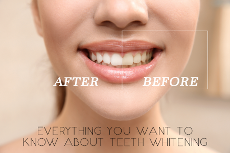 Lincoln & Grass Valley dentist Dr Kucera explains the teeth whitening process for local teens