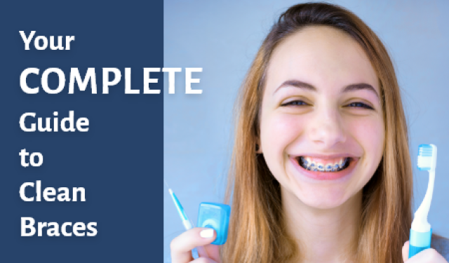 A Complete Guide for Keeping Braces Clean (featured image)