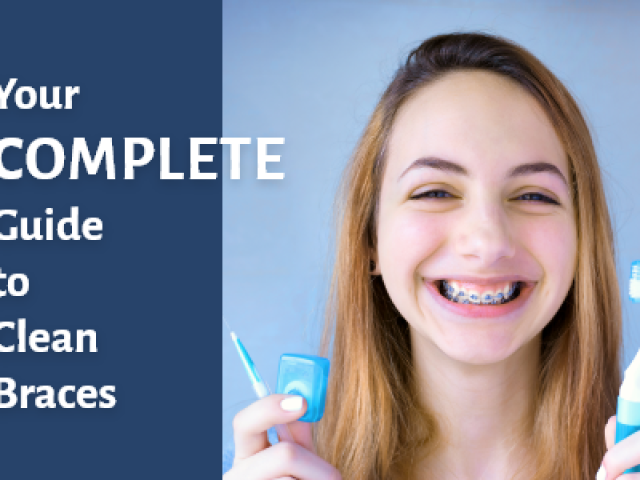 A Complete Guide for Keeping Braces Clean (featured image)