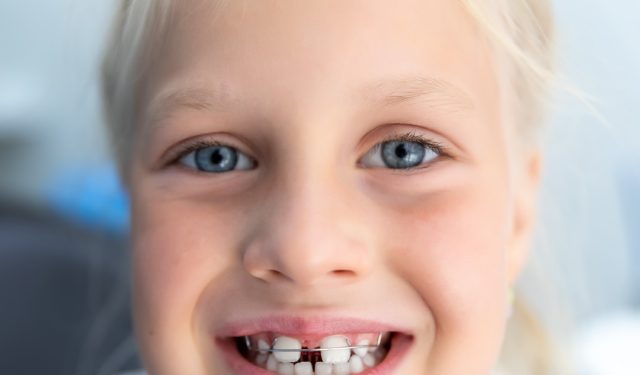 Four Signs Your Child Needs Braces (featured image)
