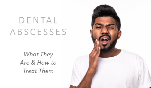 Dental Abscesses: What They Are and How to Treat Them (featured image)