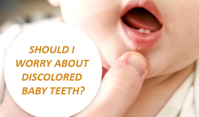 Should You Worry about Discolored Baby Teeth? (featured image)