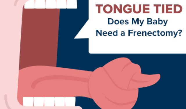 Tongue Tied: Does My Baby Need a Frenectomy? (featured image)