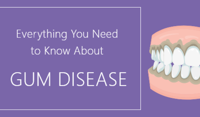 Everything You Need to Know About Gum Disease (featured image)