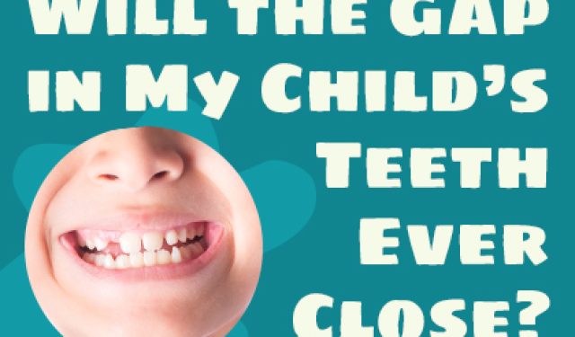 Will the Gap in My Child’s Teeth Ever Close? (featured image)