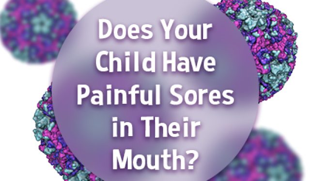Does Your Child Have Painful Sores in Their Mouth? This Virus Could be the Cause (featured image)