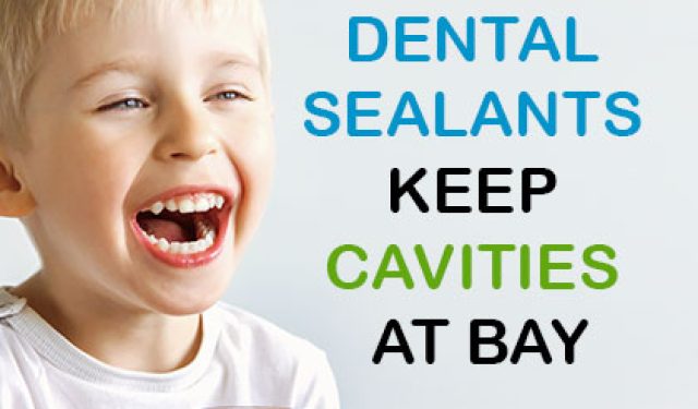 Dental Sealants Keep Cavities at Bay (featured image)
