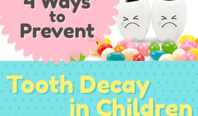 4 Ways to Prevent Tooth Decay in Children (featured image)