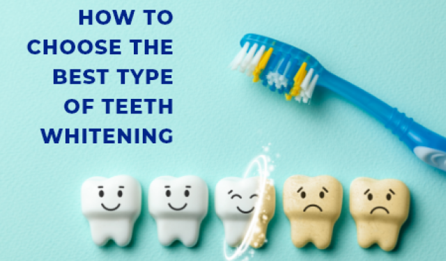 How To Choose The Best Type Of Teeth Whitening (featured image)