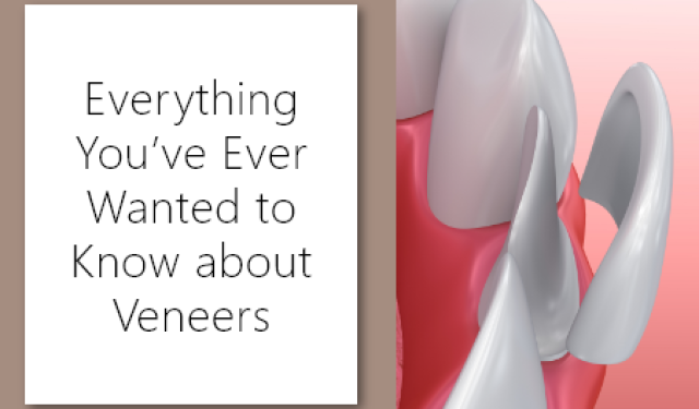 Everything You’ve Ever Wanted to Know about Veneers (featured image)